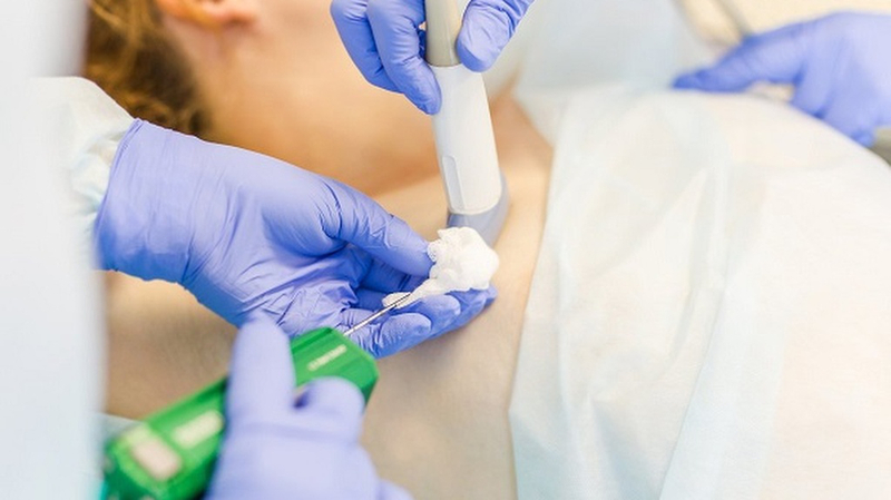 Tùy từng đối tượng sẽ được bác sĩ chỉ định thực hiện sinh thiết